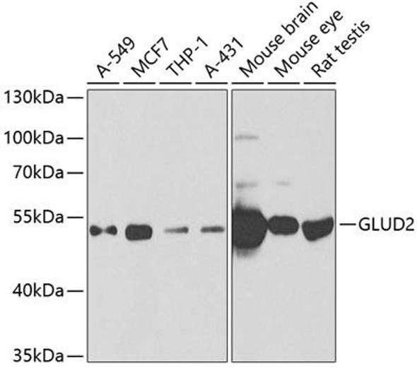 Cell Biology Antibodies 10 Anti-GLUD2 Antibody CAB6604