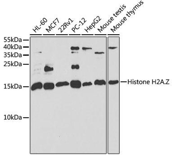 KO Validated Antibodies 1 Anti-Histone H2AZ Antibody CAB6614KO Validated