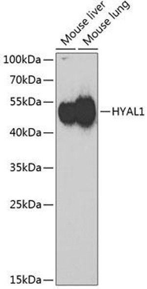 Cell Biology Antibodies 10 Anti-HYAL1 Antibody CAB6623