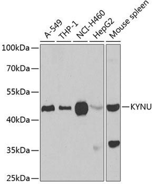 Metabolism Antibodies 2 Anti-KYNU Antibody CAB6643