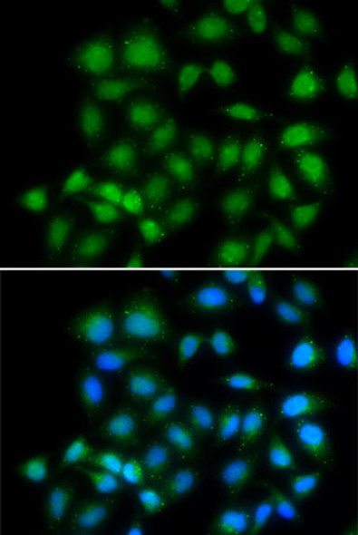 Epigenetics and Nuclear Signaling Antibodies 4 Anti-MXI1 Antibody CAB6661