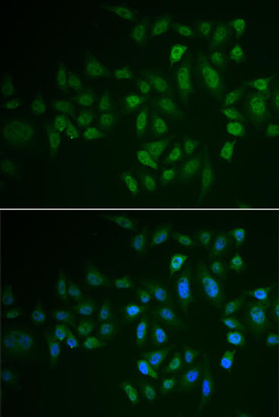 Cell Biology Antibodies 10 Anti-MYLK3 Antibody CAB6663