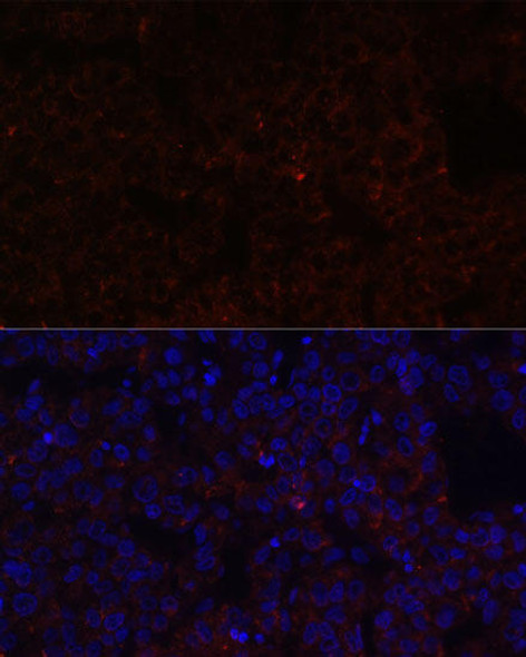 Cell Biology Antibodies 10 Anti-NNMT Antibody CAB6673