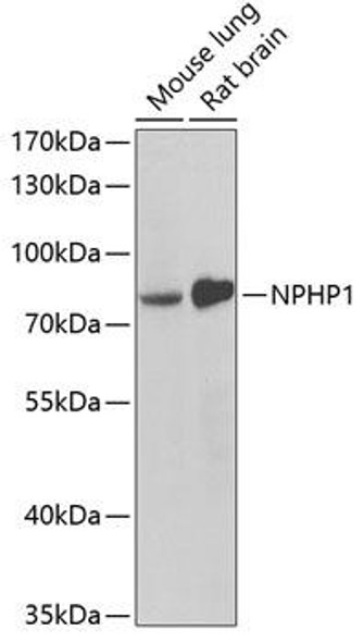 Cell Biology Antibodies 10 Anti-NPHP1 Antibody CAB6674