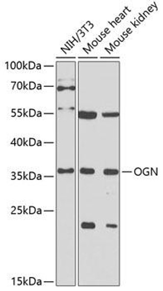 Cell Biology Antibodies 10 Anti-OGN Antibody CAB6679
