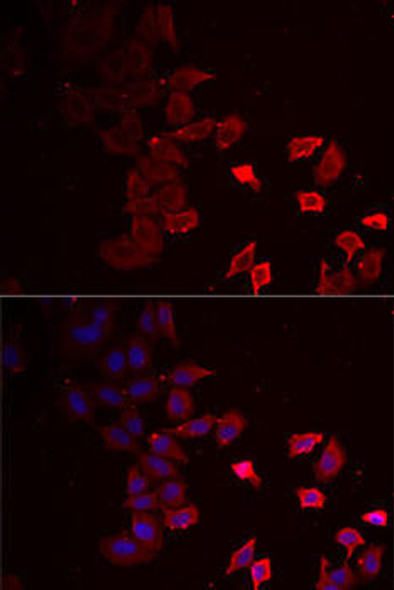 Signal Transduction Antibodies 3 Anti-P2RX4 Antibody CAB6682