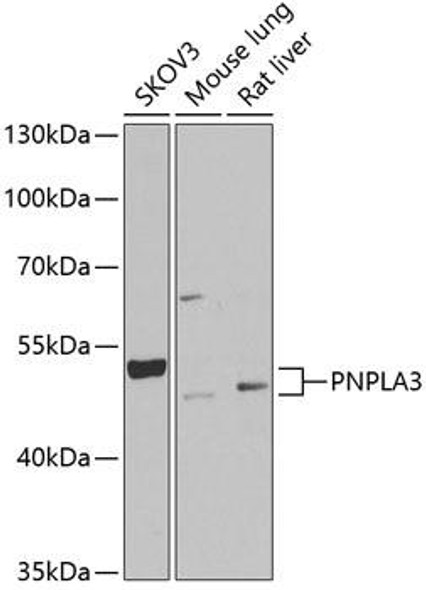 Metabolism Antibodies 2 Anti-PNPLA3 Antibody CAB6694