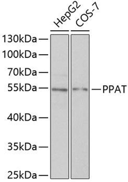 Metabolism Antibodies 2 Anti-PPAT Antibody CAB6698