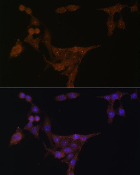 Metabolism Antibodies 2 Anti-PPAT Antibody CAB6698