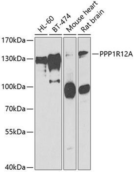 Cell Biology Antibodies 10 Anti-PPP1R12A Antibody CAB6700