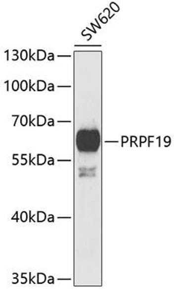 Epigenetics and Nuclear Signaling Antibodies 4 Anti-PRPF19 Antibody CAB6706