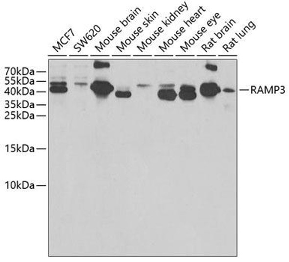 Signal Transduction Antibodies 3 Anti-RAMP3 Antibody CAB6715