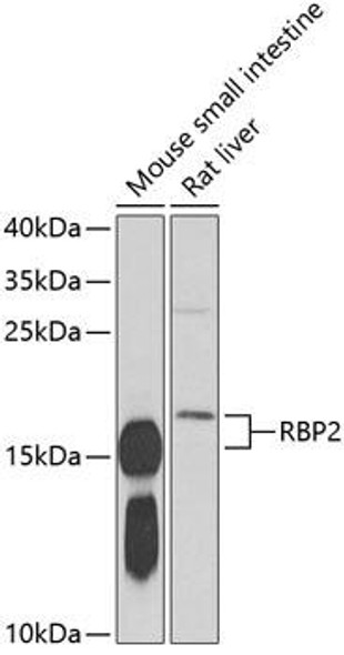 Signal Transduction Antibodies 3 Anti-RBP2 Antibody CAB6717