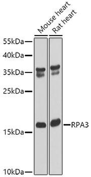 Epigenetics and Nuclear Signaling Antibodies 4 Anti-RPA3 Antibody CAB6721