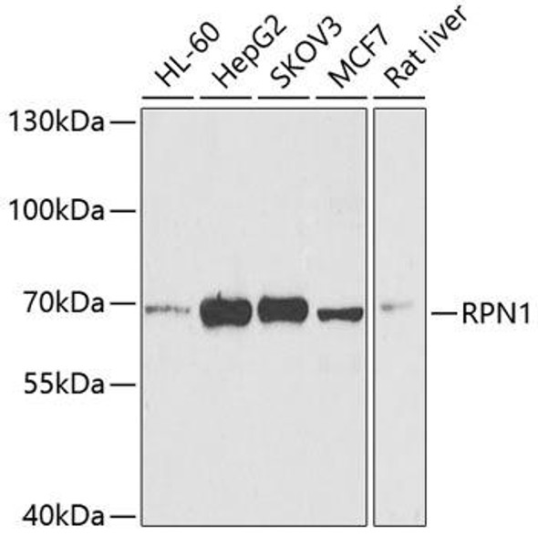 Cell Biology Antibodies 10 Anti-RPN1 Antibody CAB6726