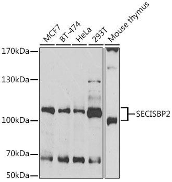 Metabolism Antibodies 2 Anti-SECISBP2 Antibody CAB6736