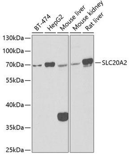 Immunology Antibodies 2 Anti-SLC20A2 Antibody CAB6739