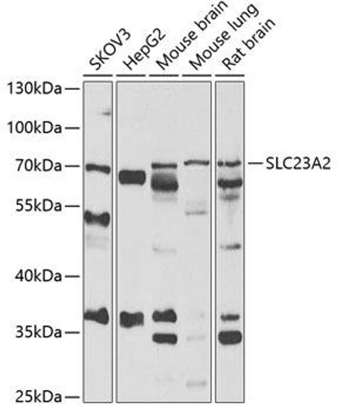 Signal Transduction Antibodies 3 Anti-SLC23A2 Antibody CAB6740