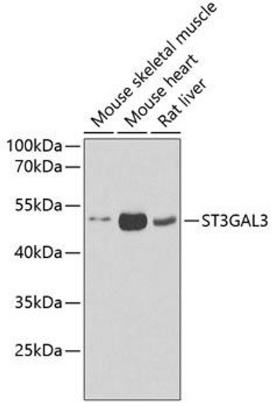 Cell Biology Antibodies 10 Anti-ST3GAL3 Antibody CAB6753