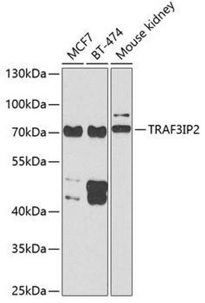 Cell Biology Antibodies 10 Anti-TRAF3IP2 Antibody CAB6776