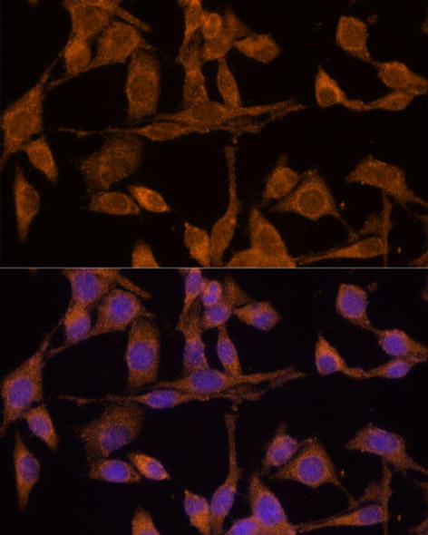 Immunology Antibodies 2 Anti-USP15 Antibody CAB6786