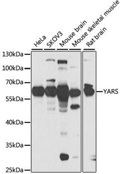 Metabolism Antibodies 2 Anti-YARS Antibody CAB6791