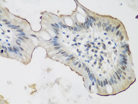 Immunohistochemistry of paraffin-embedded rat lung using ALOX15 antibody at dilution of 1:200 (40x lens). Perform microwave antigen retrieval with 10 mM PBS buffer pH 7. 2 before commencing with IHC staining protocol.