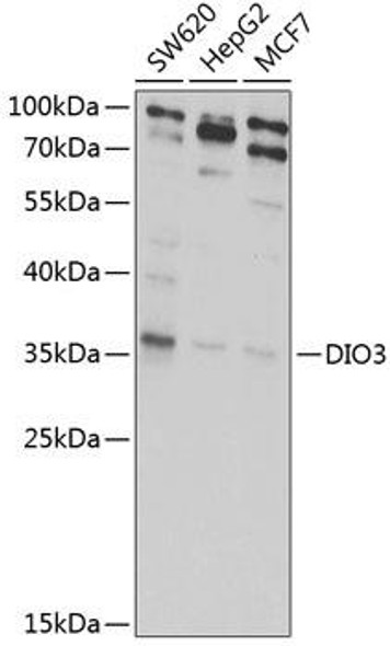 Metabolism Antibodies 2 Anti-DIO3 Antibody CAB6900