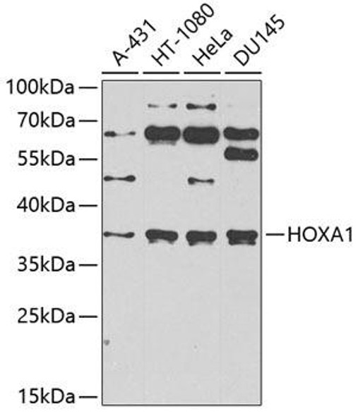 Epigenetics and Nuclear Signaling Antibodies 4 Anti-HOXA1 Antibody CAB6924