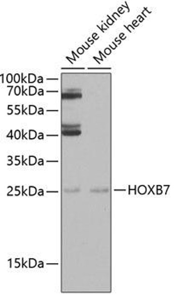 Epigenetics and Nuclear Signaling Antibodies 4 Anti-HOXB7 Antibody CAB6925