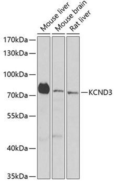 Signal Transduction Antibodies 3 Anti-KCND3 Antibody CAB6927