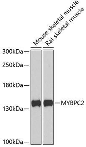 Cell Biology Antibodies 10 Anti-MYBPC2 Antibody CAB6934