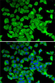 Epigenetics and Nuclear Signaling Antibodies 4 Anti-PARN Antibody CAB6941