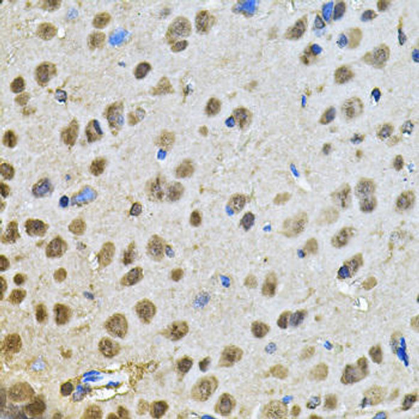 Cell Death Antibodies 2 Anti-PPID Antibody CAB6949