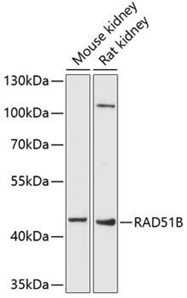Epigenetics and Nuclear Signaling Antibodies 4 Anti-RAD51B Antibody CAB6962