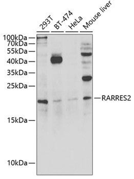 Cell Biology Antibodies 10 Anti-RARRES2 Antibody CAB6963