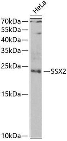 Epigenetics and Nuclear Signaling Antibodies 4 Anti-SSX2 Antibody CAB6989