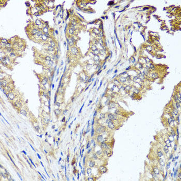 Cell Death Antibodies 2 Anti-STK3 Antibody CAB6992