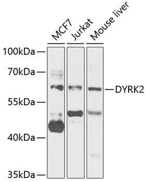 Cell Death Antibodies 2 Anti-DYRK2 Antibody CAB7012
