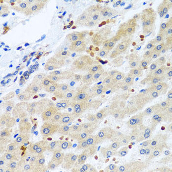 Cell Biology Antibodies 10 Anti-RGS5 Antibody CAB7015