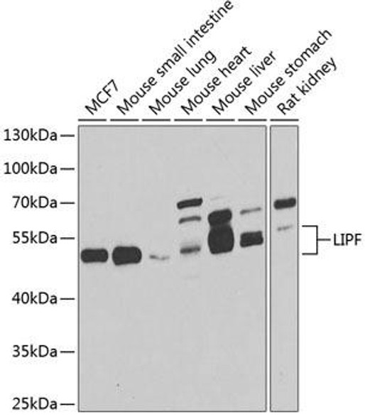 Metabolism Antibodies 2 Anti-LIPF Antibody CAB7016