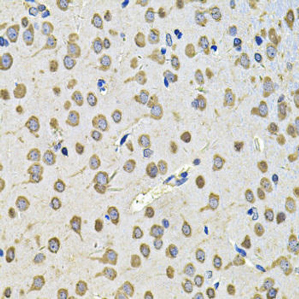 Metabolism Antibodies 2 Anti-EIF3F Antibody CAB7023