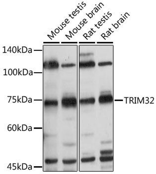 Signal Transduction Antibodies 3 Anti-TRIM32 Antibody CAB7079