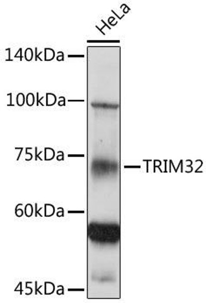 Signal Transduction Antibodies 3 Anti-TRIM32 Antibody CAB7079