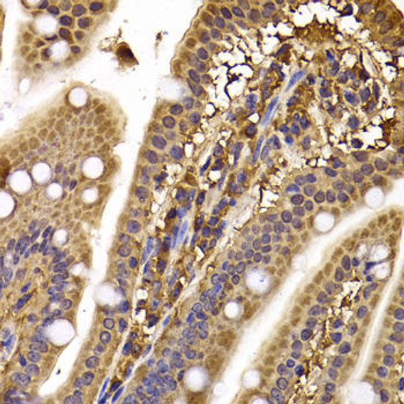 Cell Cycle Antibodies 2 Anti-CLASP1 Antibody CAB7081