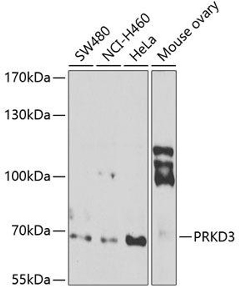 Cell Biology Antibodies 10 Anti-PRKD3 Antibody CAB7084