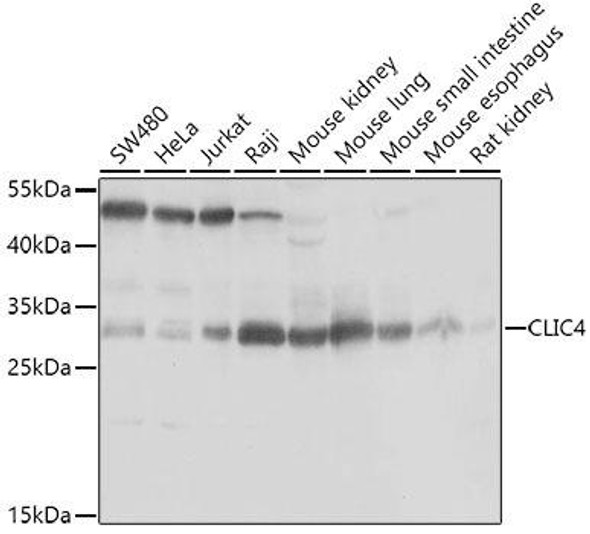 Signal Transduction Antibodies 3 Anti-CLIC4 Antibody CAB7088