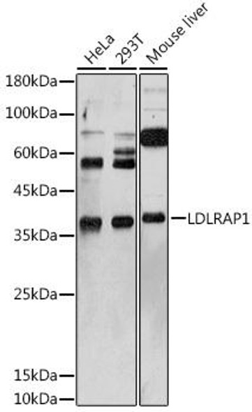 Metabolism Antibodies 2 Anti-LDLRAP1 Antibody CAB7093