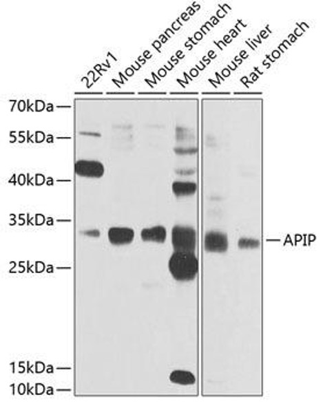 Metabolism Antibodies 2 Anti-APIP Antibody CAB7102