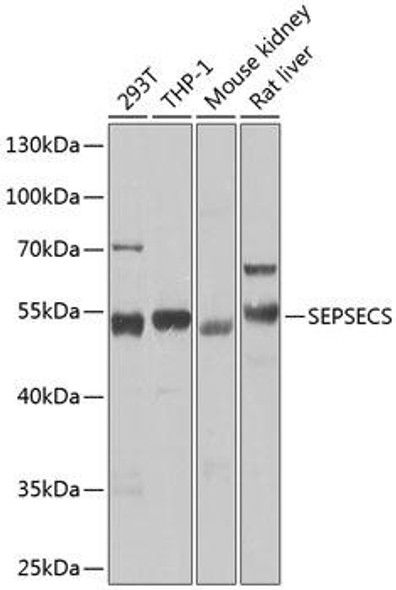 Metabolism Antibodies 2 Anti-SEPSECS Antibody CAB7103